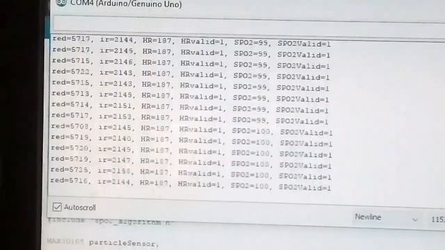 MAX30102 ,Arduino, Pcf8574 & 16by2 LCD, Pulse Oximeter SSD1306. смотреть онлайн