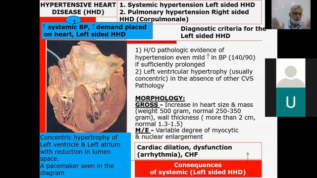 Hypertension heart disease смотреть онлайн