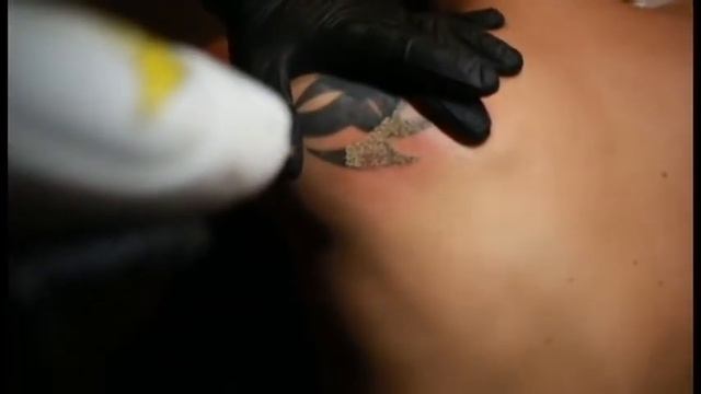 Лазерное удаление татуировки в Пространстве DV SPACE/ laser removal tattoo смотреть онлайн