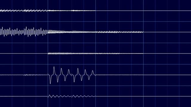 @MPXVM Fumix 204 Chill (XM) on Corrscope смотреть онлайн