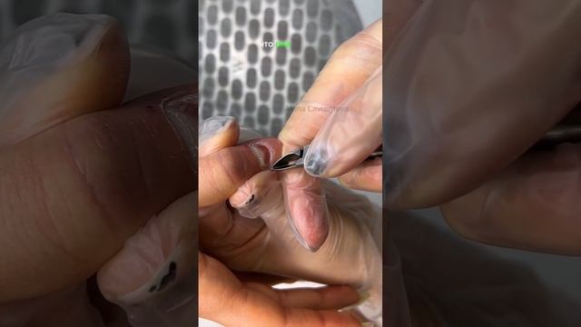 Можно ли ставить титановую нить на руку? Уже посмотрели эти два визита на канале? смотреть онлайн