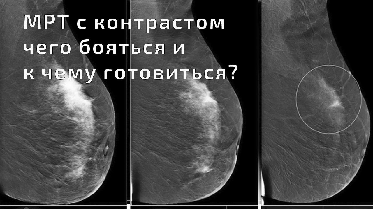 МРТ с контрастом- чего бояться и к чему готовиться