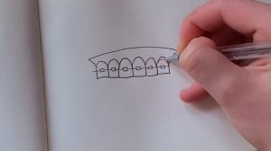 УХОД ЗА БРЕКЕТАМИ // ИРРИГАТОР