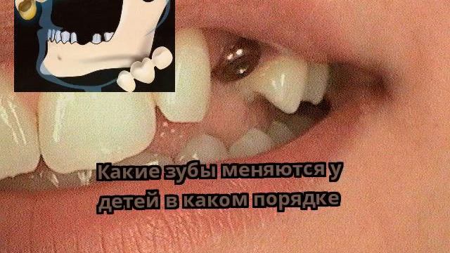 Какие зубы меняются у детей в каком порядке смотреть онлайн