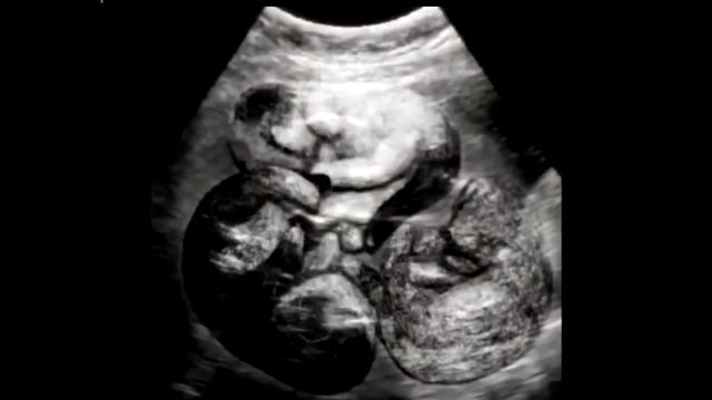 Кошку привезли на усыпление. Но когда ветеринар осмотрел её, он выгнал хозяев из клиники... смотреть онлайн