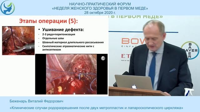 «Клинические случаи родоразрешения после двух метропластик и лапароскопического циркляжа» смотреть онлайн
