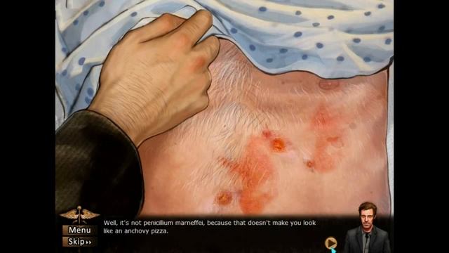 IMPLANTS? - House, M.D. The Game - (Part 4) смотреть онлайн