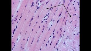 мышечные ткани. гистологические препараты