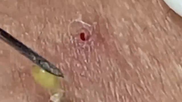 Enjoy Every Day With Loan Nguyen Spa Beauty New Video | 008