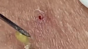 Enjoy Every Day With Loan Nguyen Spa Beauty New Video | 008