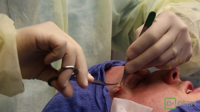 Double Eyebrow Cyst смотреть онлайн