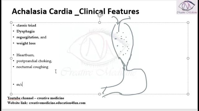 Lec 3 Achalasia Cardia Clinical Features mp4 || GIT смотреть онлайн