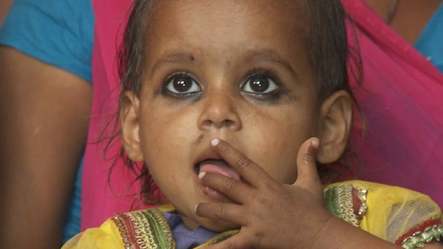 The Vision of ACF to Create Malnutrition Free Nepal - Action Against Hunger (ACF) смотреть онлайн