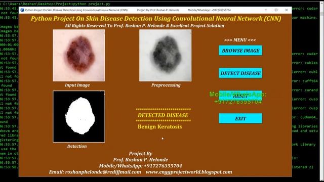 Skin Disease Detection Using Neural Network Python OpenCV Project Source Code смотреть онлайн