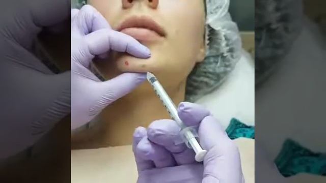 Делаем красивый подбородок