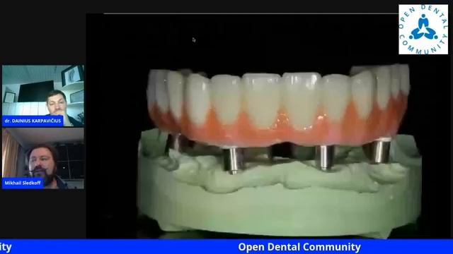 Тотальные протезы с опорой на 4-6-8 имплантов Решение в CAD-CAM технологиях из различных материало смотреть онлайн