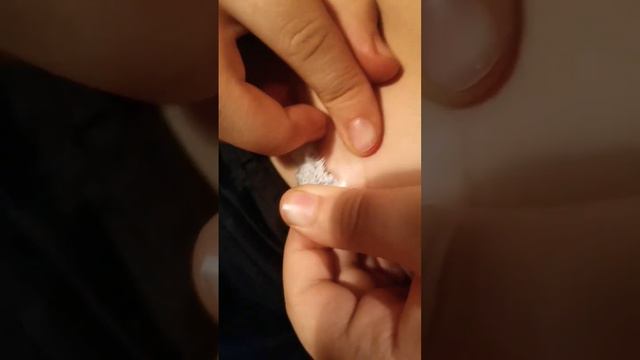 Замена инфузионного набора помпа медтроник 754. #помпа #инсулин #диабет1тип #мамаСахарка смотреть онлайн