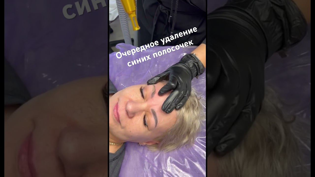 Удаляем старый татуаж. Сколько же их еще !?!