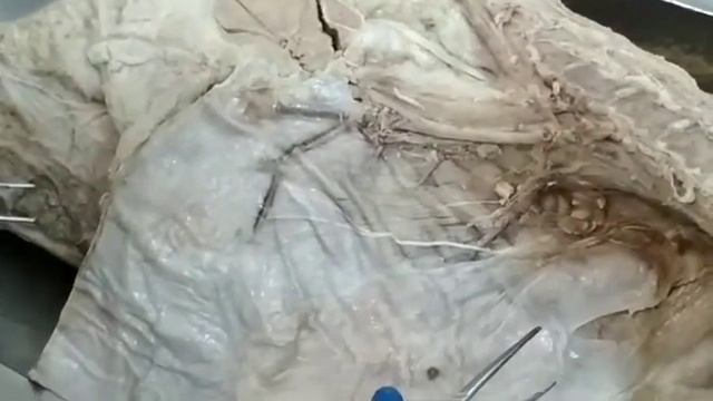 Судини тазової кінцівки. Ч1 смотреть онлайн