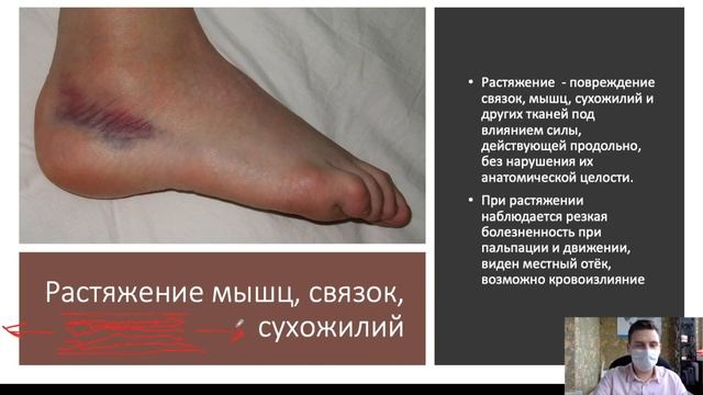 Первая помощь при ушибах, растяжениях, вывихах смотреть онлайн