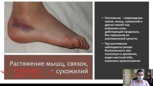 Первая помощь при ушибах, растяжениях, вывихах
