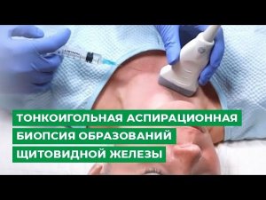 Тонкоигольная аспирационная биопсия образований щитовидной железы
