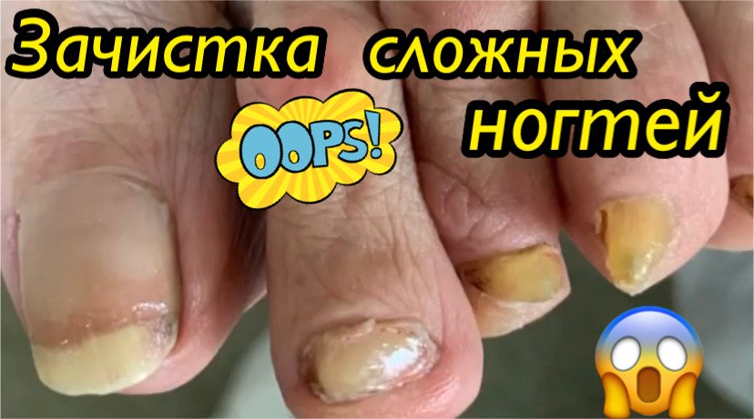 Зачистка сложных ногтей?⚠️❗️?? смотреть онлайн
