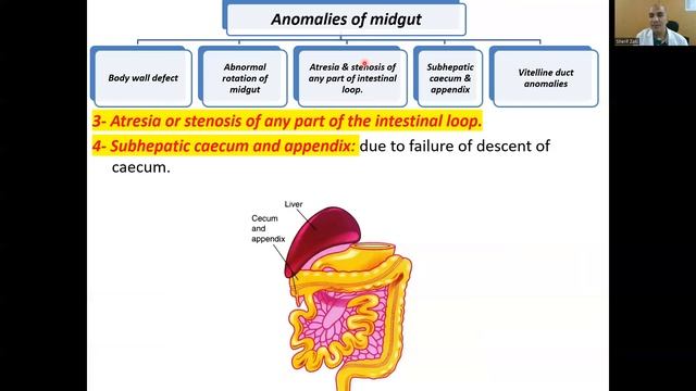 Midgut & hindgut (Revision 7)(Nutrition & GIT 7) смотреть онлайн