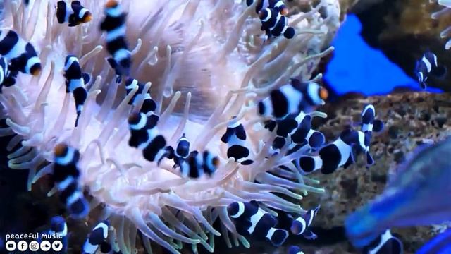 Лечебная музыка для сердца и сосудов ? Музыка для глубокого сна и расслабления для души смотреть онлайн