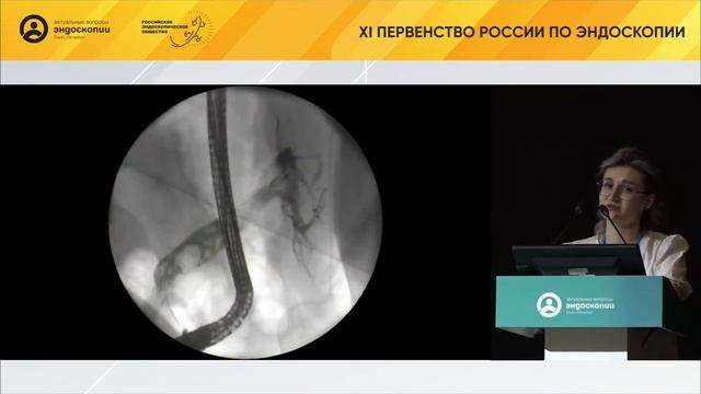 Современные возможности пероральной холангиоскопии: маленькая причина большой проблемы смотреть онлайн