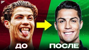 Звезды футбола, которые сделали ПЛАСТИЧЕСКУЮ ОПЕРАЦИЮ!