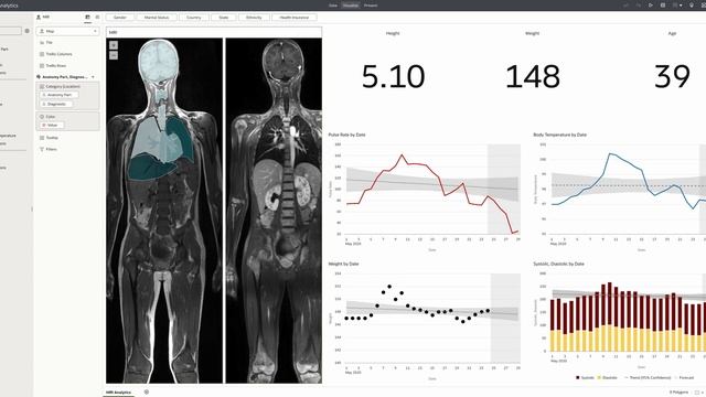 Oracle Analytics Cloud Demo - MRI Diagnostic смотреть онлайн