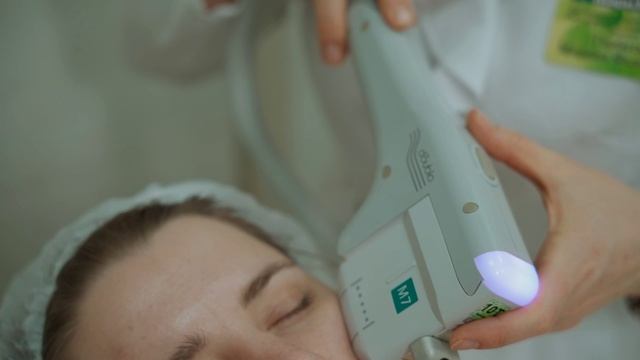 Ультразвуковой SMAS-лифтинг смотреть онлайн