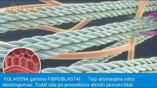 MIKROADATINĖ PROCEDŪRA Klaipedoje 868770119 1 смотреть онлайн