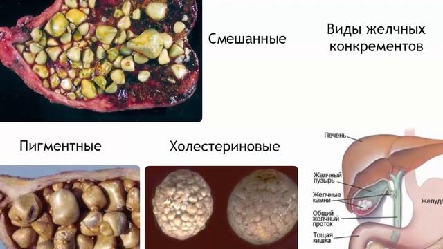Польза ячневой крупы только научные факты и исследования смотреть онлайн