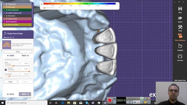 How to design a Toronto bridge (thimble crown ) step by step in exocad 3.0 Galway смотреть онлайн