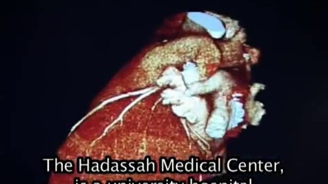 Медицина Израиля - Клиника Хадасса смотреть онлайн