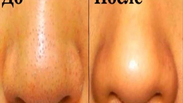 Как убрать черные точки смотреть онлайн