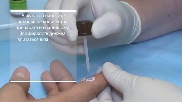 Веррукацид — видео-инструкция по применению смотреть онлайн