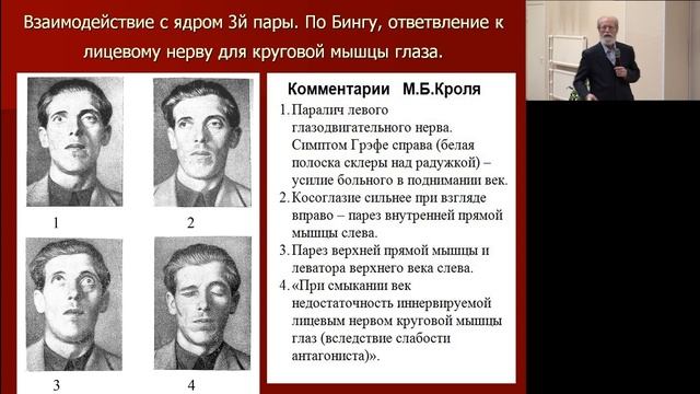 доцент Ю.К. Кодзаев "Невропатия лицевого нерва: неизвестное об известном" смотреть онлайн