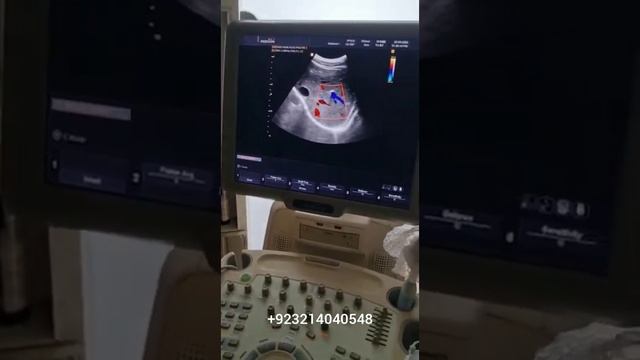 Samsung Medison X8 смотреть онлайн