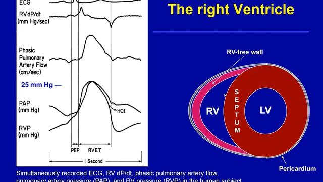The right ventricle and heart-lung interaction Marco Maggiorini