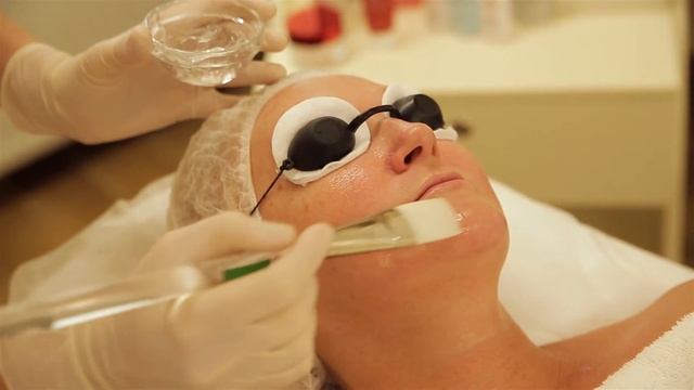 IPL – терапия. Фотоомоложение.