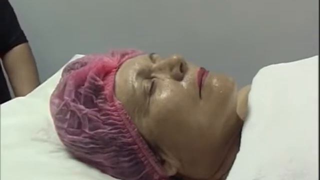 миндальный пилинг смотреть онлайн