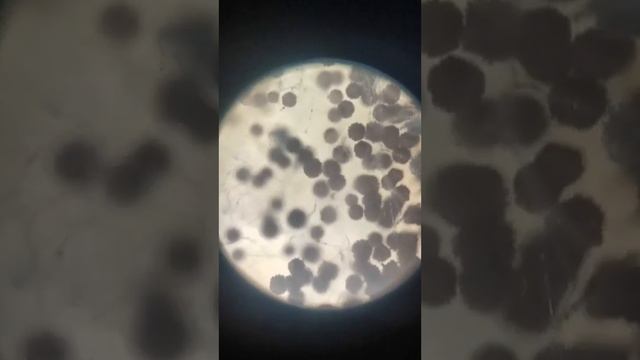 Плесень ? смотреть онлайн