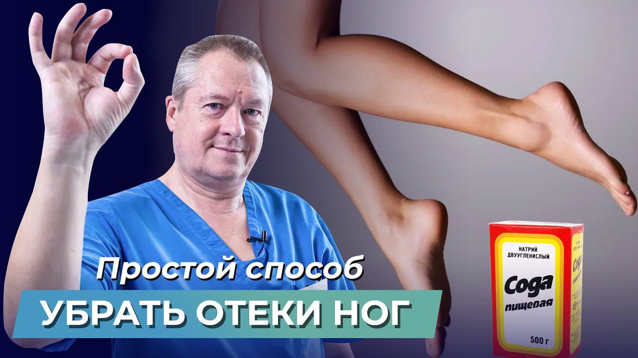Избавьтесь от ОТЕКОВ ног с помощью 1 процедуры! Отекают ноги: что делать? Отёки на ногах лечение