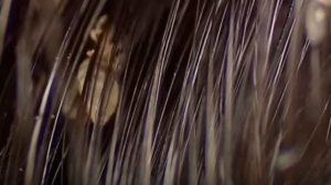 Несколько ФАКТОВ О ВШАХ. Узнай о ПАРАЗИТАХ как ВШИ немного БОЛЬШЕ!