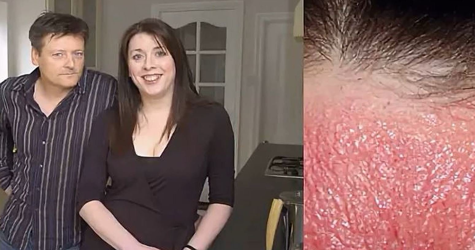 Эта женщина вынуждена отказаться от телефона и компьютера из за аллергии. смотреть онлайн