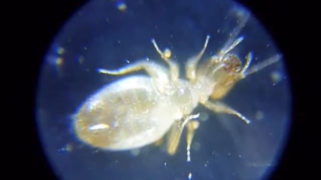 Маленькое коричневое насекомое в гречке под микроскопом смотреть онлайн
