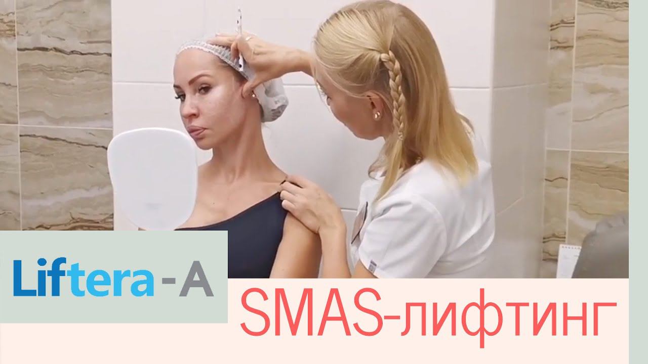 СМАС-лифтинг: как проходит процедура, до и после